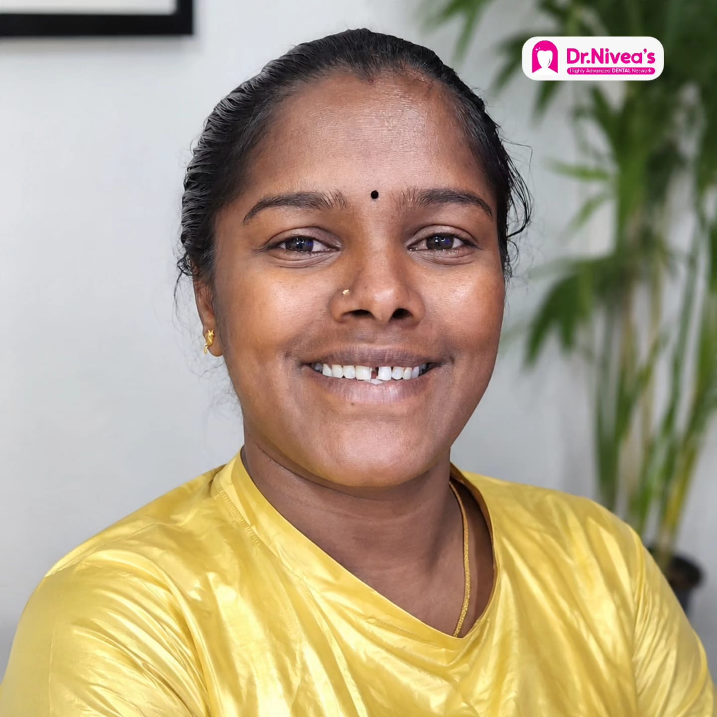 Patient's smile before treatment at Dr. Nivea's Advanced Dental Network